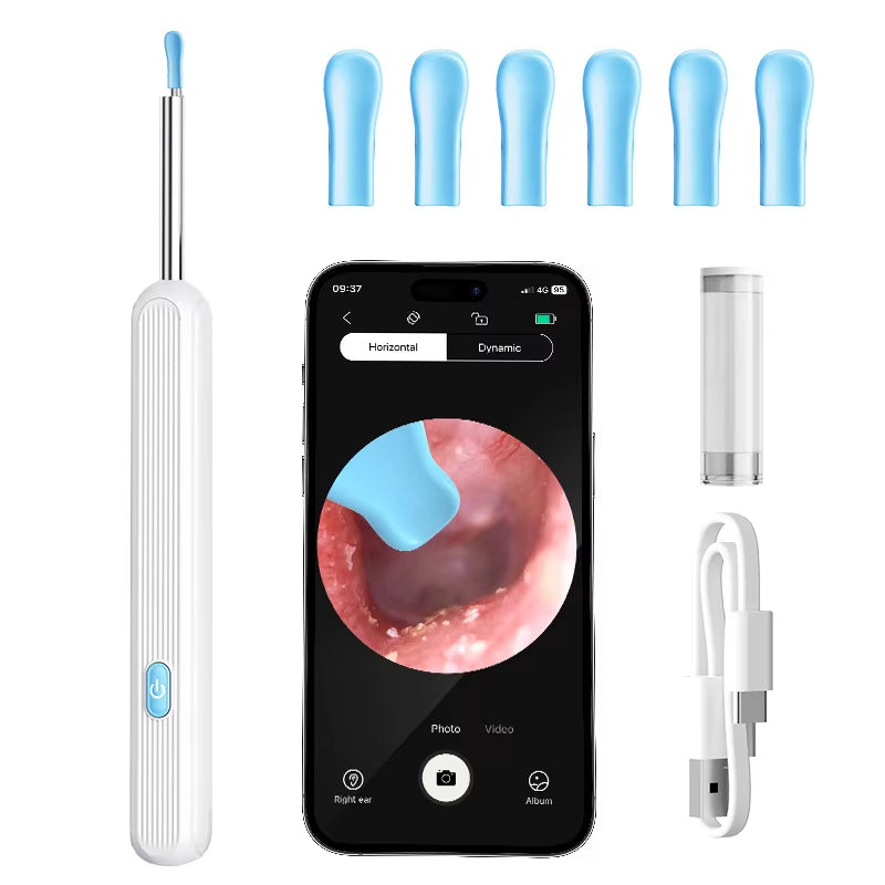 mart Visual Ear Sticks WiFi Otoscope & Wax Removal Tool”